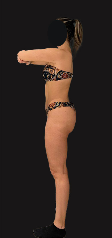 antes-depois-duplo-1.1