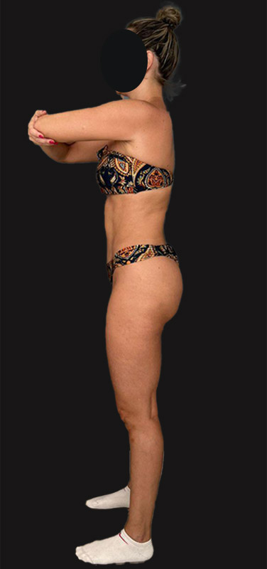 antes-depois-duplo-1.2