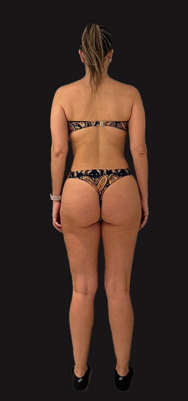 antes-depois-duplo-2.1