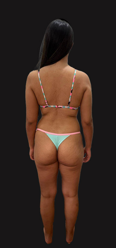 antes-depois-duplo-4.1