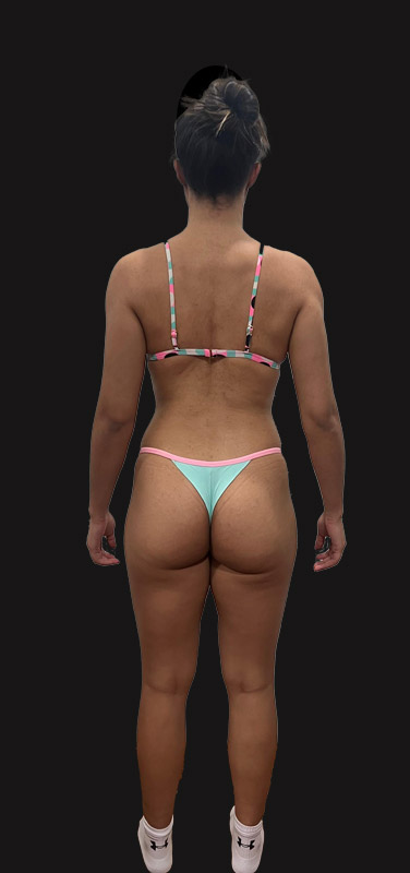 antes-depois-duplo-4.2