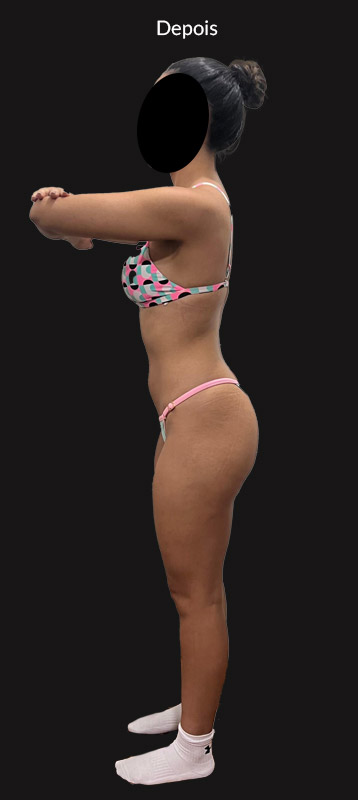 antes-depois-duplo-5-2