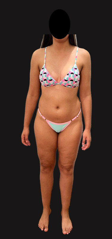 antes-depois-duplo-6.1