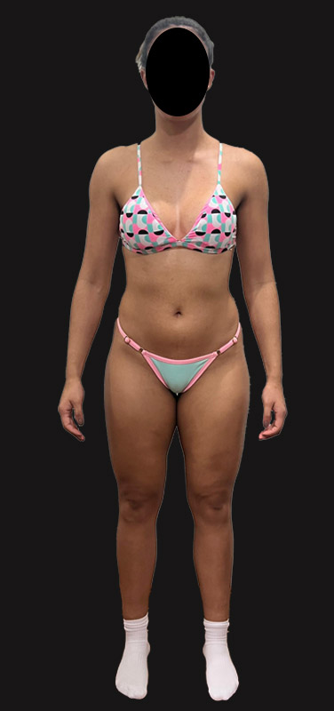 antes-depois-duplo-6.2