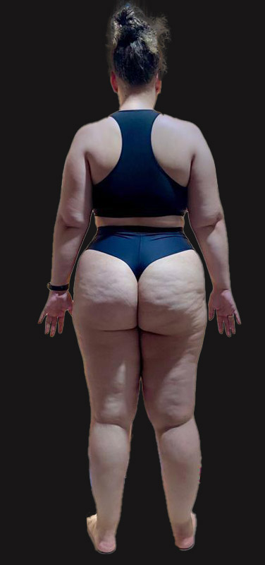 antes-depois-duplo-7.1