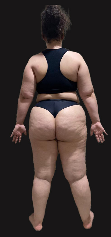 antes-depois-duplo-7.2