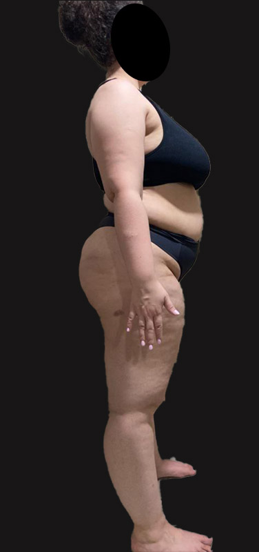 antes-depois-duplo-8.1