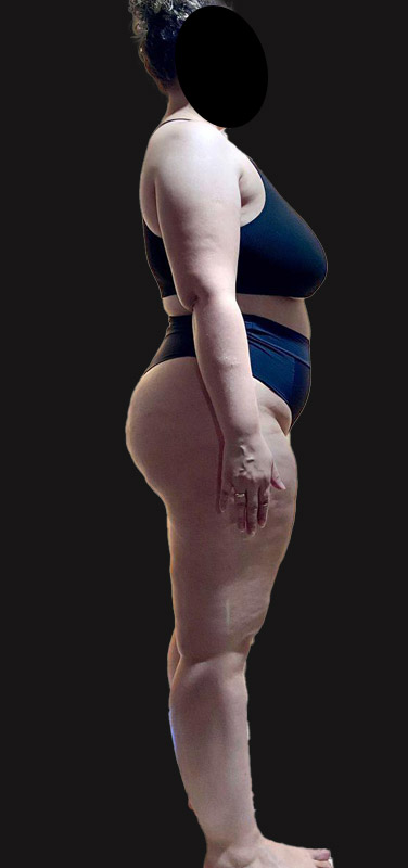 antes-depois-duplo-8.2