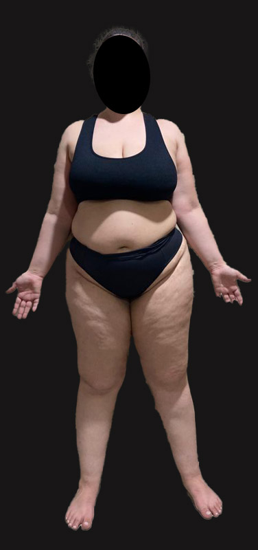 antes-depois-duplo-9.1