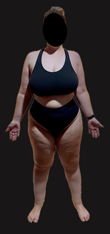 antes-depois-duplo-9.2